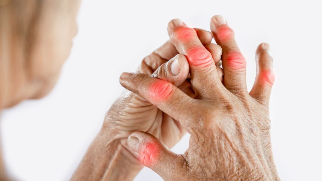 Age-related joint pain